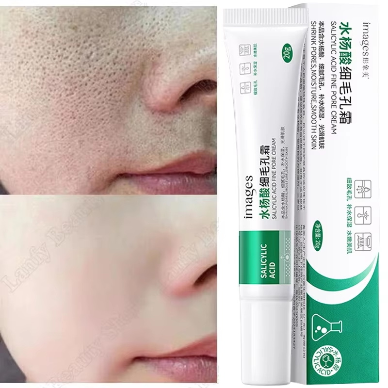 Salicylzuur Poriënreinigende C - Salicylic Acid Blackhead Remover recensie en prijs